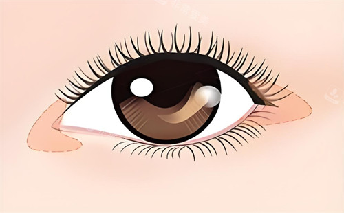 开内外眼角的卡通图