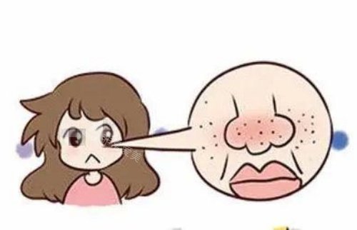 鼻子部位毛孔粗大示意图