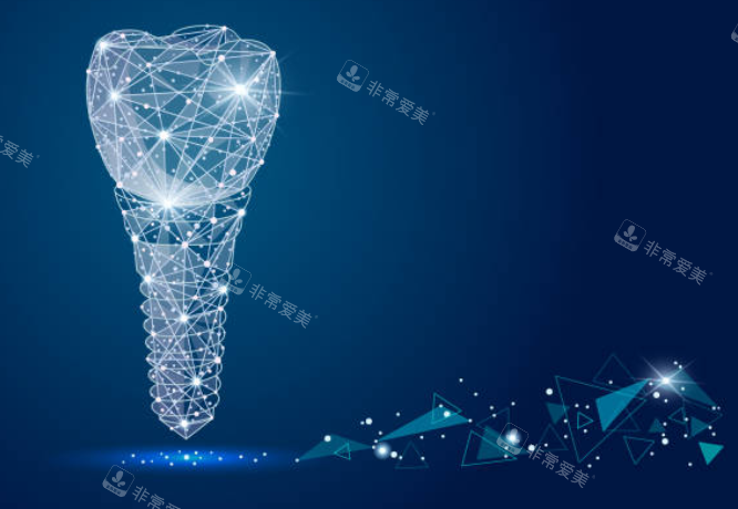 种植牙模拟图示意图