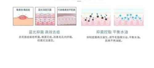 韩国祛痘痘的医院哪家好?灿真韩医院在论岘路八五街43，韩医分型祛痘更靠谱