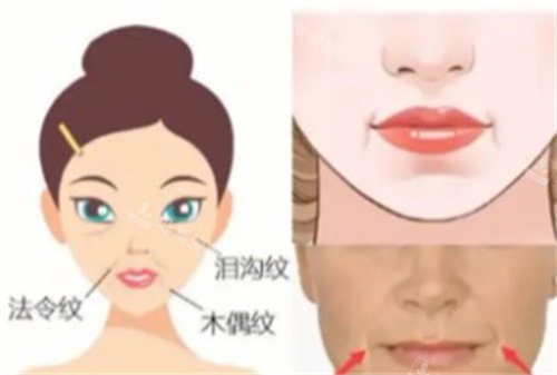 微拉美手术改善 微拉美手术改善