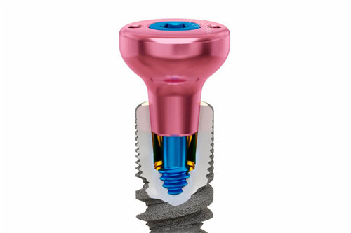 种植牙愈合基台透视图