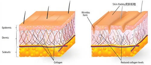热拉提原理 热拉提原理
