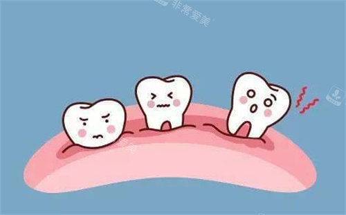 牙龈萎缩卡通展示图片