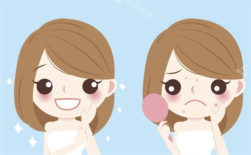 祛痘前后对比卡通图片