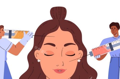 面部注射卡通示意展示 面部注射卡通示意展示