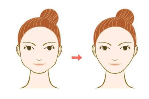 昆明博美微拉美面部提...