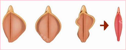 昆明博美私密整形采用...