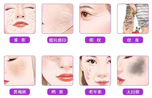 不同的皮肤斑点问题 不同的皮肤斑点问题