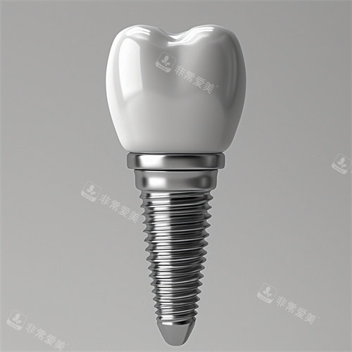 种植牙植体和牙冠一提漫画示意图
