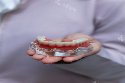 牙齿制作模型示意展示