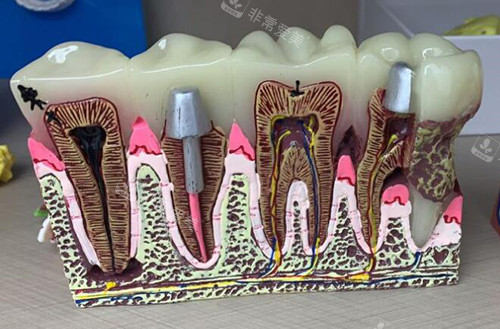 萍乡北一口腔牙齿模型