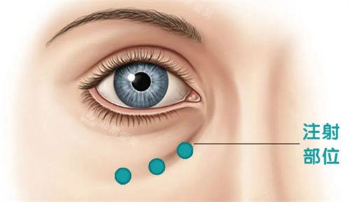 韩国岛山Mili Clinic皮肤科怎么样?韩国本地人私藏的宝藏皮肤管理圣地！非流水线操作+进口激光设备！