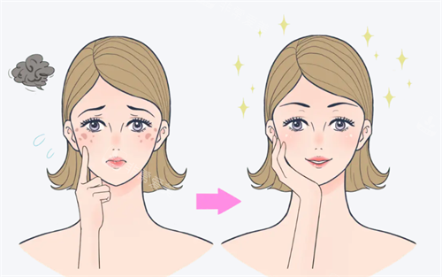 祛斑对比 祛斑对比