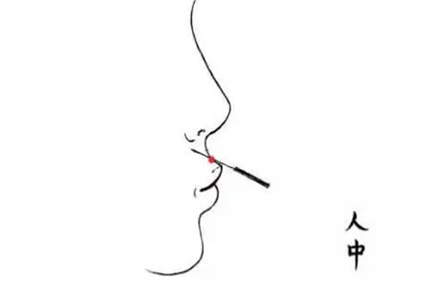 人中加深玻尿酸