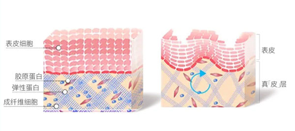 艾维岚填充皮肤示意图