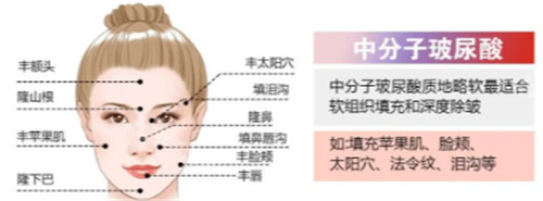 中分子玻尿酸简介