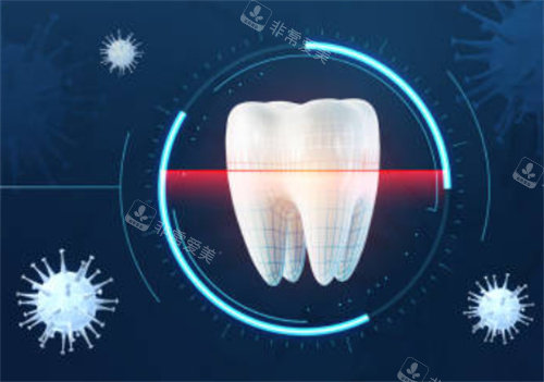 牙齿检查是否有细菌图