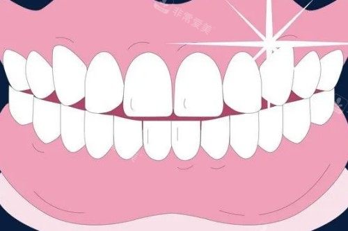 整齐牙齿卡通图