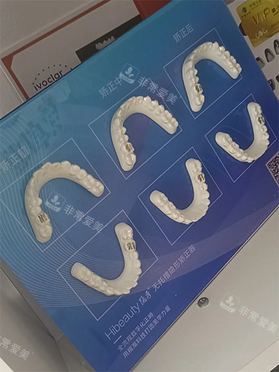 隐秀隐形牙齿矫正