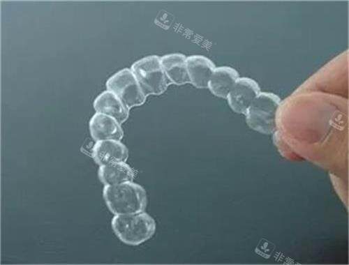 隐形牙齿矫正器示意图