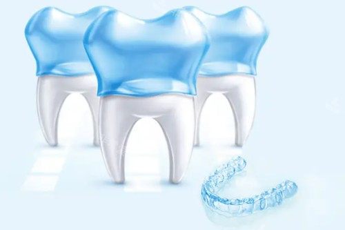 隐形矫正卡通模型图