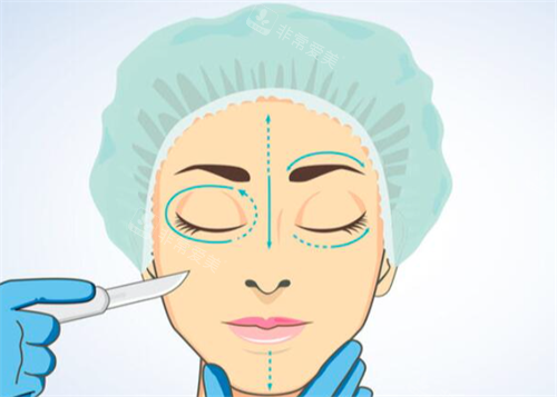 韩国林克 整形外科医院怎么样？江南的综合医美机构，眼鼻/形体/肚脐整形技术与服务全解析