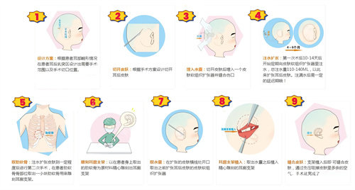 郑州整形美容医院怎么样?眼修复基地认证，耳再造/丰胸/轻医美实力获求美者认可