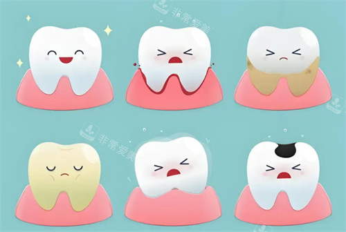 健康牙齿与不健康牙齿的状态