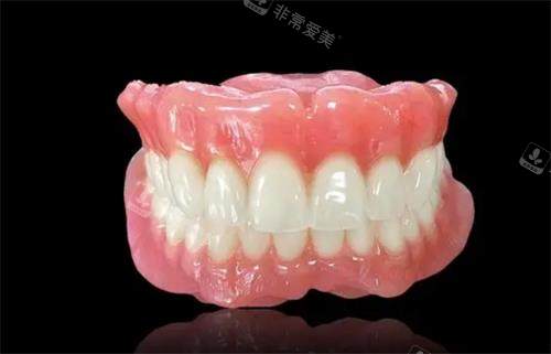 吸附式假牙的示意图