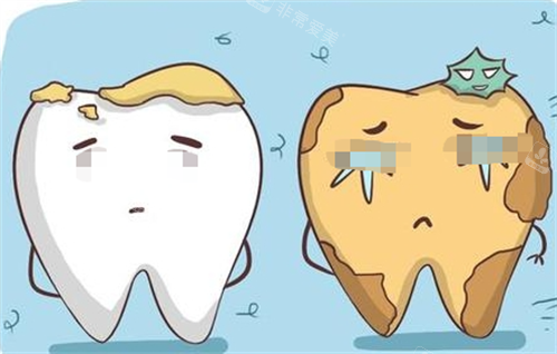 烂牙齿动画形象展示图