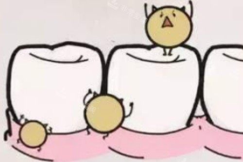 牙齿有细菌卡通图