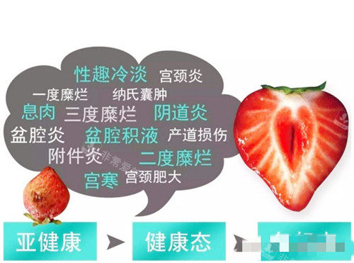 菲蜜丽解问题图示