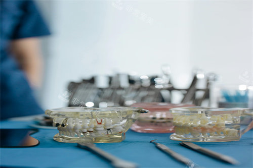 牙齿治疗的模型图