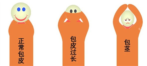 包皮过长、包茎、正常