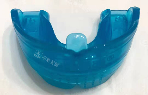 牙齿矫正MRC早期肌功能矫正器4