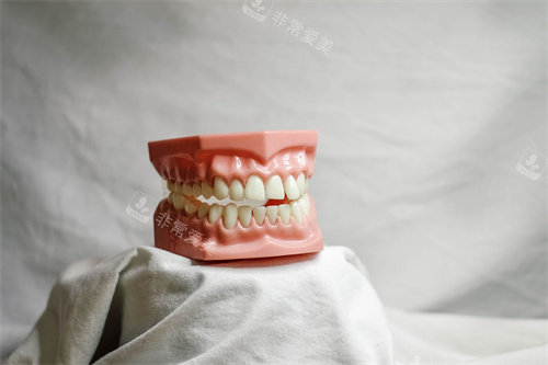 牙齿模型展示宣传