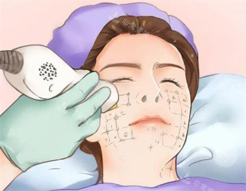 热玛吉卡通图片