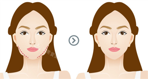 韩国爱妮皮肤科简介！...