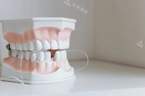 残缺的牙齿展示