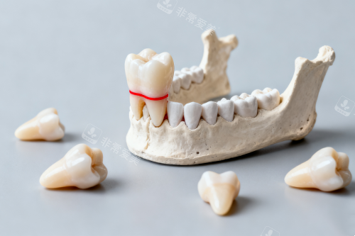 牙齿模型图片一览
