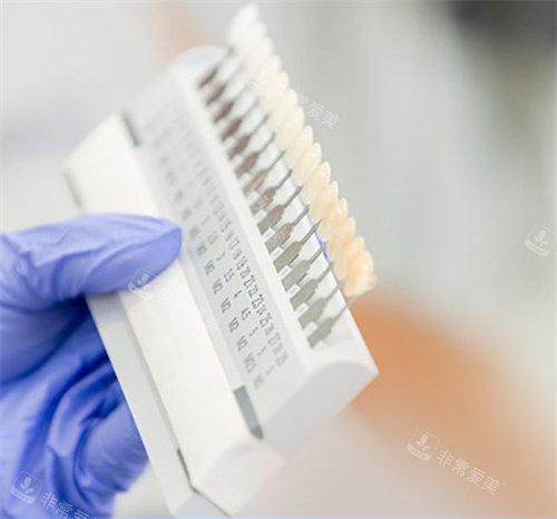 牙齿贴面不同颜色