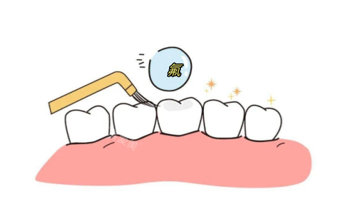 儿童牙齿涂氟动画展示图