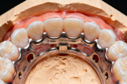 牙齿矫正之后的样子展示