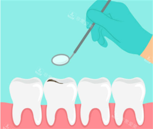 牙齿检查卡通图片