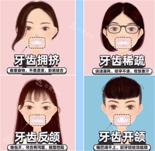 牙齿矫正自查表