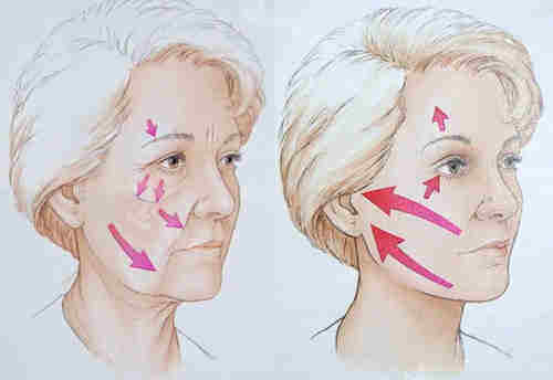 韩国theheal皮肤科怎么样？超赞！定制诊疗口碑佳介绍详细体验超安心