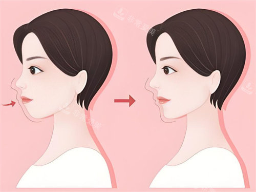 牙齿矫正前后对比