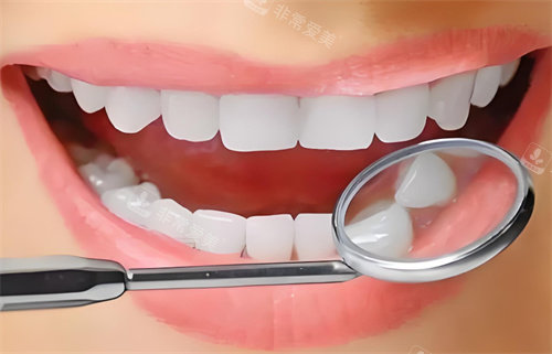 牙齿检查图片展示