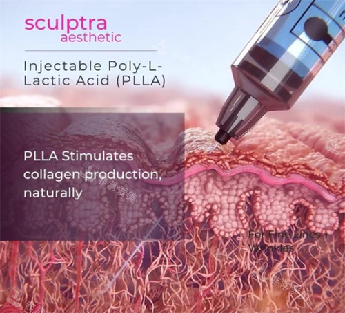 塑妍萃注射深度